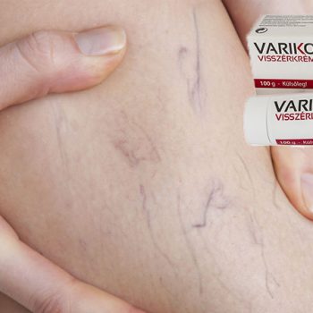varikopax_web Varikopax visszérkrém