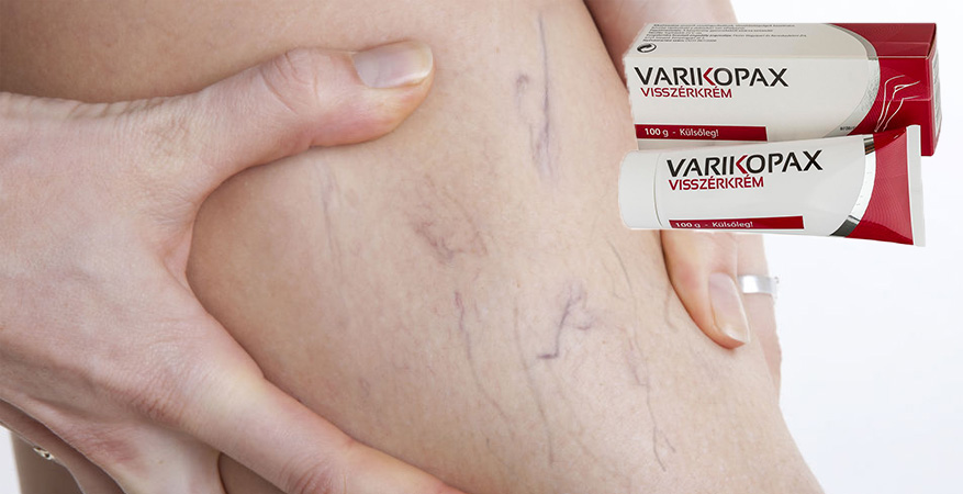 Varikopax visszérkrém